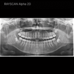 Alpha 2D - Image 3