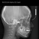 Alpha 2D - Image 4