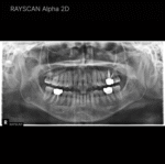Alpha 2D - Image 6