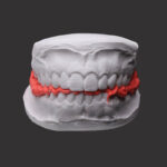 Registro de Mordida Scan Bite Yller - Image 2