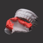Registro de Mordida Scan Bite Yller - Image 3