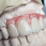 Kit de Tintes Dentales Cosmos Creation Yller - Image 2