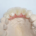 Kit de Tintes Dentales Cosmos Creation Yller - Image 3