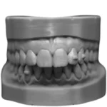 Resina Cosmos Plus 3D (Dental Model) - Image 3