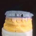 Resina Cosmos Splint 3D Biocompatible Yller - Image 2